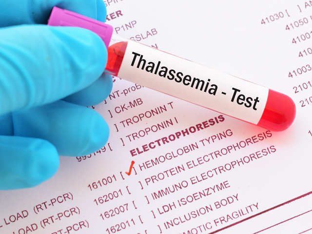 Acute Myeloid Leukemia: Putting Light on FLT3 Mutation